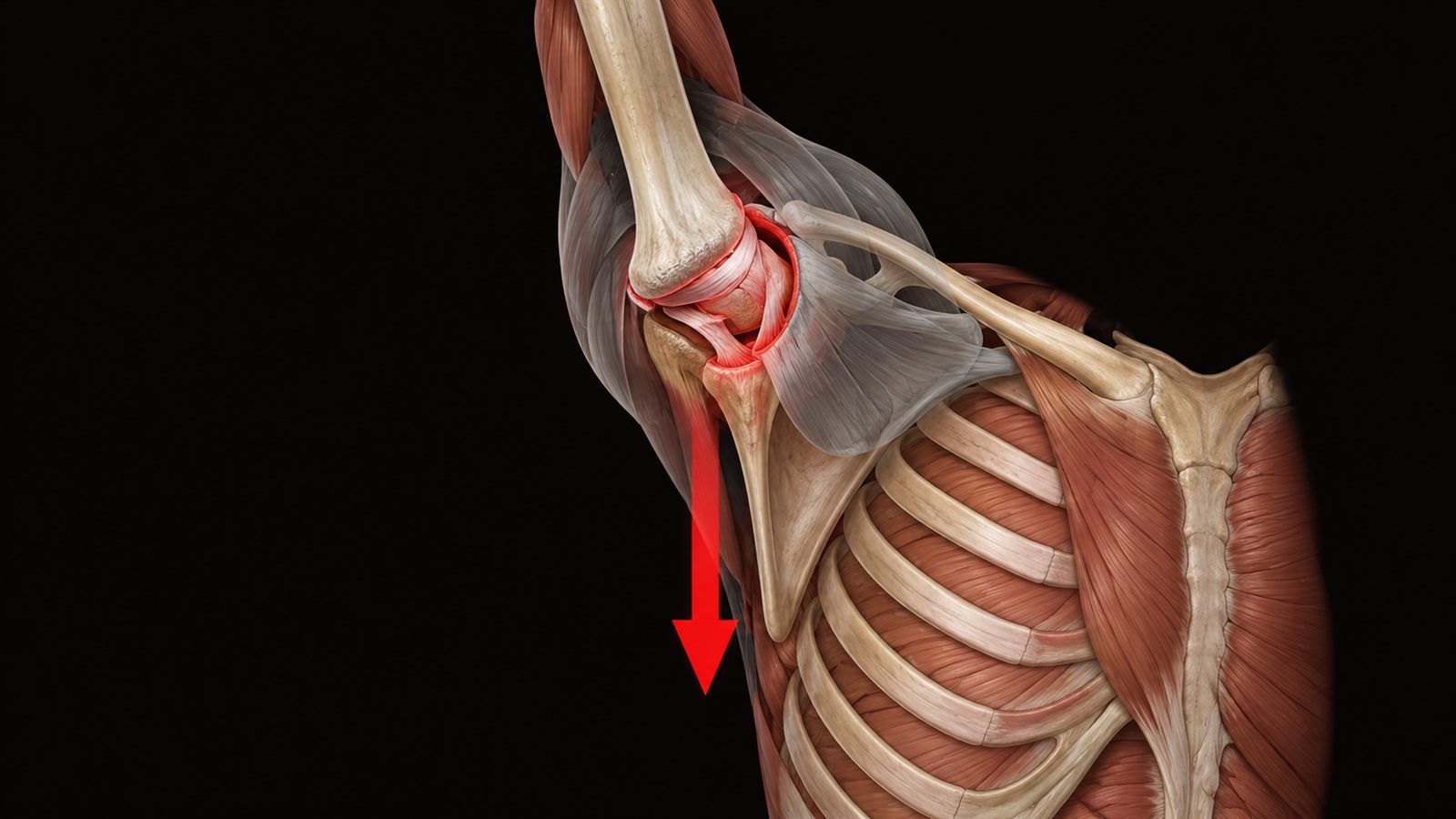 Épaule en suspension passive : le poids du corps tire la tête de l'humérus et la capsule et le labrum encaissent